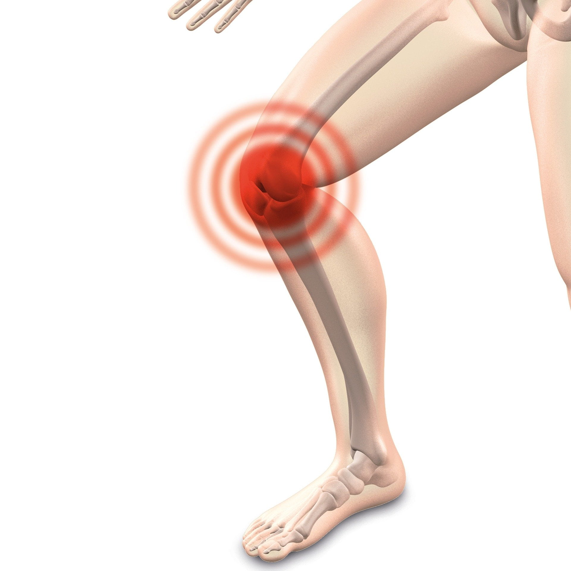 arthrocalman-2384253_1920 arthrocalman-2384253_1920